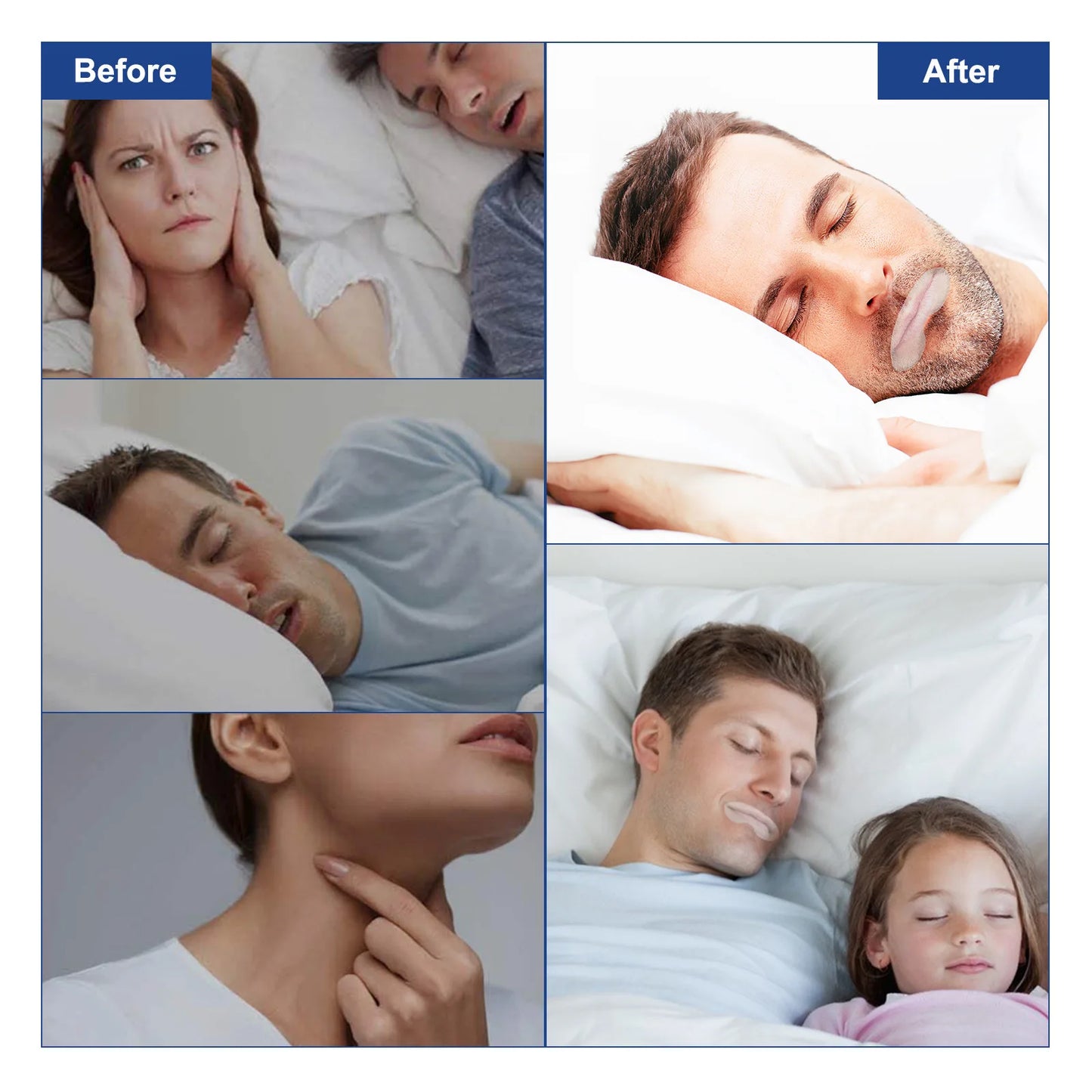 ELAIMEI Anti Snoring Sleep Strips